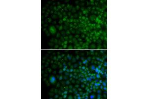 Immunofluorescence analysis of U20S cell using ANG antibody. (ANG antibody  (AA 25-147))