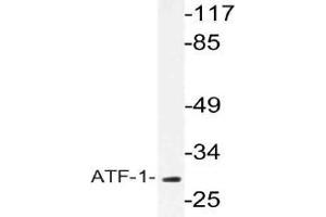 Western blot (WB) analysis of ATF-1 antibody in extracts from COLO cells. (AFT1 antibody)