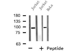 Western blot analysis of extracts from HeLa/Jurkat cells, using PTPN22 antibody.
