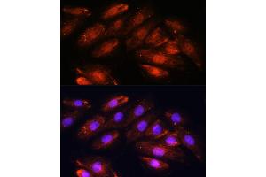 Immunofluorescence analysis of H9C2 cells using OTUB1 antibody (ABIN6128400, ABIN6145086, ABIN6145088 and ABIN6215346) at dilution of 1:100. (OTUB1 antibody  (AA 1-220))