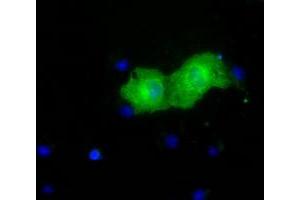Anti-PKLR mouse monoclonal antibody (ABIN2453475) immunofluorescent staining of COS7 cells transiently transfected by pCMV6-ENTRY PKLR (RC206455). (PKLR antibody)