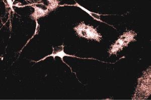 Immunofluorescent staining of Rat Neurons with anti-Adaptin gamma antibody. (gamma 1 Adaptin antibody  (AA 642-821))