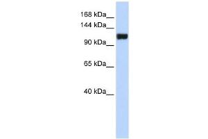 FAM120A antibody used at 1 ug/ml to detect target protein. (FAM120A antibody  (Middle Region))