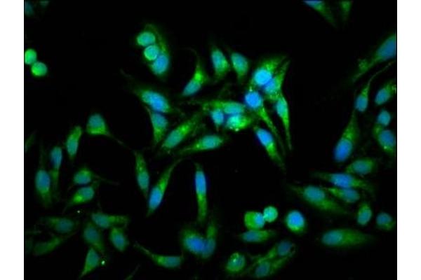 ACOT1 antibody  (AA 258-350)