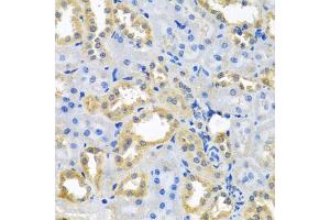 Immunohistochemistry of paraffin-embedded rat kidney using NDUFB10 antibody (ABIN5972156) at dilution of 1/100 (40x lens). (NDUFB10 antibody)