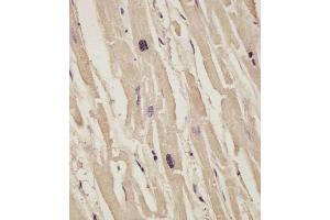 (ABIN6242834 and ABIN6578871) staining COL14A1 in human heart tissue sections by Immunohistochemistry (IHC-P - paraformaldehyde-fixed, paraffin-embedded sections).