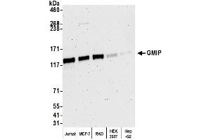 Western Blotting (WB) image for anti-GEM Interacting Protein (GMIP) (AA 920-970) antibody (ABIN7452654)
