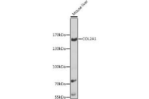 Western blot analysis of extracts of mouse liver, using COL2 antibody (560) at 1:1000 dilution. (COL2A1 antibody  (AA 873-1072))