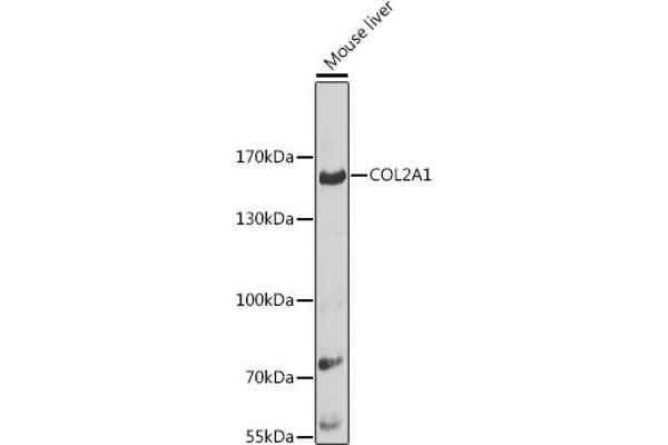 COL2A1 anticorps  (AA 873-1072)