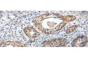 ZPBP antibody