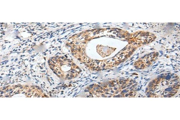 ZPBP antibody