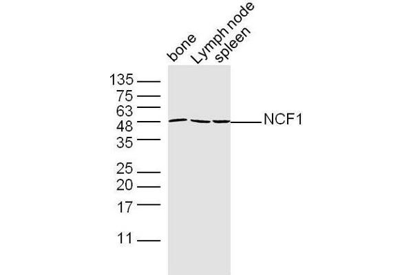 NCF1 antibody  (AA 151-250)