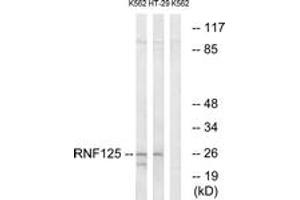 Western blot analysis of extracts from K562/HT-29 cells, using RNF125 Antibody.