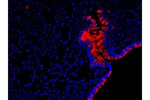 Image no. 1 for anti-RELM alpha antibody (ABIN465191) (RELM alpha antibody)