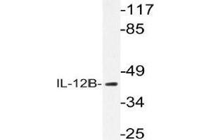 Western blot (WB) analysis of IL-12B antibody in extracts from K562 cells. (IL12B antibody)