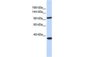 Image no. 1 for anti-Pappalysin 2 (PAPPA2) (AA 108-157) antibody (ABIN6743109) (PAPPA2 antibody  (AA 108-157))