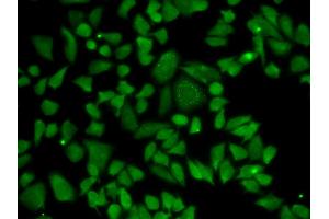 Immunofluorescence analysis of A549 cells using ALDH2 antibody. (ALDH2 antibody)
