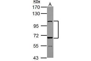 WB Image Sample (30 ug of whole cell lysate) A: JC 7. (ADAMTS5 antibody  (C-Term))