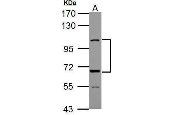 ADAMTS5 抗体  (C-Term)