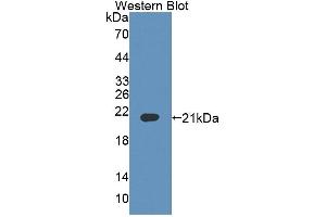 Detection of Recombinant BTLA, Mouse using Polyclonal Antibody to B And T-Lymphocyte Attenuator (BTLA) (BTLA antibody  (AA 30-183))