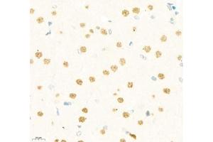 Immunohistochemistry of paraffin embedded rat brain using LDOCL (ABIN7075411) at dilution of 1:1400 (400x lens) (Retrotransposon Gag-Like Protein 6 (RTL6) antibody)