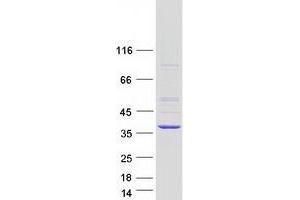 Western Blotting (WB) image for Ribonuclease H2, Subunit A (RNASEH2A) protein (Myc-DYKDDDDK Tag) (ABIN2730998)
