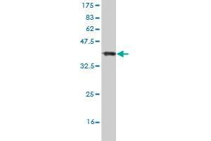 Western Blot detection against Immunogen (37. (HIPK2 antibody  (AA 961-1065))