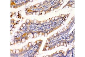 IHC analysis of EpCAM using anti-EpCAM antibody (ABIN7600081).