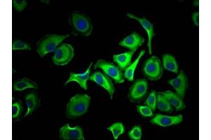 Immunofluorescence staining of HepG2 Cells with ABIN7127352 at 1:50, counter-stained with DAPI. (Recombinant ACLY antibody)