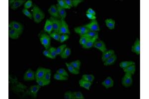 Immunofluorescence staining of HepG2 cells with ABIN7155567 at 1:66, counter-stained with DAPI. (HLA-C antibody  (AA 200-306))