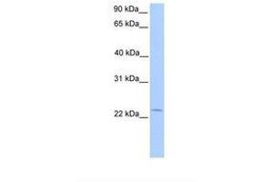 Chromosome 5 Open Reading Frame 39 (C5orf39) (N-Term) antibody