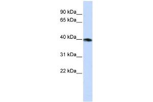 GNAZ antibody used at 1 ug/ml to detect target protein. (GNaZ antibody)