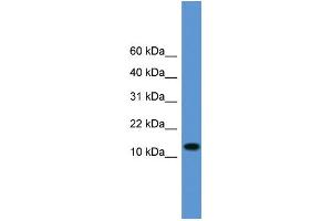 WB Suggested Anti-TAC1 Antibody Titration: 1. (TAC1 antibody  (Middle Region))