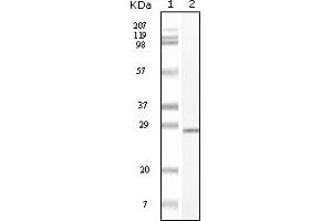 Western Blotting (WB) image for anti-Mast/stem Cell Growth Factor Receptor (KIT) (truncated) antibody (ABIN2464038) (KIT antibody  (truncated))