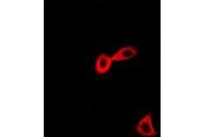 Immunofluorescent analysis of CARS staining in Hela cells. (CARS antibody)