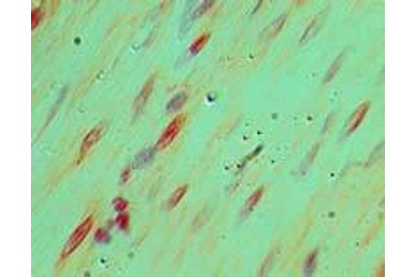 LRRFIP2 antibody  (AA 150-200)