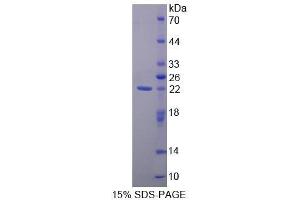 SDS-PAGE (SDS) image for Protein Tyrosine Phosphatase, Receptor Type, N (PTPRN) (AA 35-185) protein (His tag) (ABIN1879571) (PTPRN Protein (AA 35-185) (His tag))