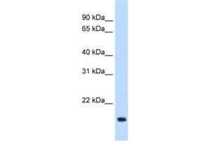 Western Blotting (WB) image for anti-Regulator of G-Protein Signaling 2 (RGS2) antibody (ABIN2462639)