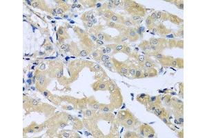 Immunohistochemistry of paraffin-embedded Human stomach using HS1BP3 Polyclonal Antibody at dilution of 1:100 (40x lens). (HS1BP3 antibody)