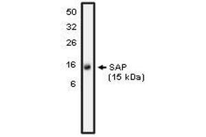 Image no. 1 for anti-SH2 Domain Containing 1A (SH2D1A) antibody (ABIN1502673) (SH2D1A antibody)