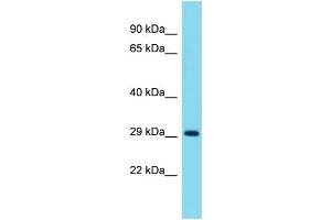 Western Blotting (WB) image for anti-Syntaxin 8 (STX8) (C-Term) antibody (ABIN2506119) (STX8 antibody  (C-Term))