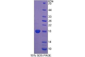 Image no. 1 for Dual Specificity Phosphatase 5 (DUSP5) (AA 1-135) protein (His tag) (ABIN4990493)