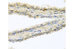 Immunohistochemistry of paraffin-embedded Human prostate using GPLD1 Polyclonal Antibody at dilution of 1:100 (40x lens). (GPLD1 antibody)
