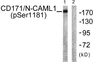 Western blot analysis of extracts from K562 cells, using CD171/N-CAML1 (Phospho-Ser1181) antibody. (L1CAM antibody  (pSer1181))