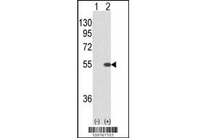 Western blot analysis of STK40 using rabbit polyclonal STK40 using 293 cell lysates (2 ug/lane) either nontransfected (Lane 1) or transiently transfected with the STK40 gene (Lane 2). (STK40 antibody  (C-Term))