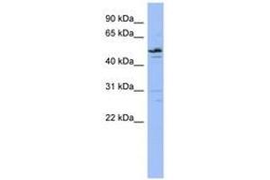 Image no. 1 for anti-Zinc Finger Protein 419 (ZNF419) (AA 107-156) antibody (ABIN6742639) (ZNF419 antibody  (AA 107-156))