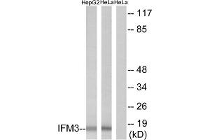 Western blot analysis of extracts from HepG2 cells and HeLa cells, using IFM3 antibody. (IFITM3 antibody  (N-Term))