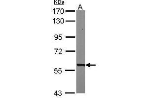 Western Blotting (WB) image for anti-phosphoglycerate Dehydrogenase (PHGDH) (N-Term) antibody (ABIN2855237)