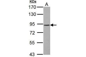 WB Image GABA B Receptor 1 antibody [N2C1], Internal detects GABBR1 protein by Western blot analysis. (GABBR1 antibody)