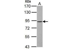 GABBR1 antibody